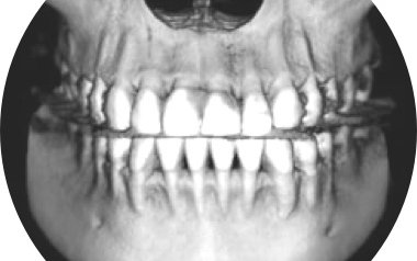 Диагностика зубов и челюстей