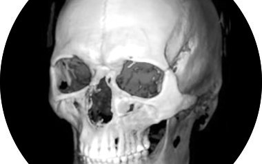 Диагностика челюстно-лицевой области (ЧЛО)